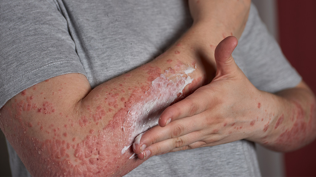 Nutrisi Penanganan Sel Abnormal